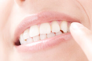 ホワイト二ングとは？